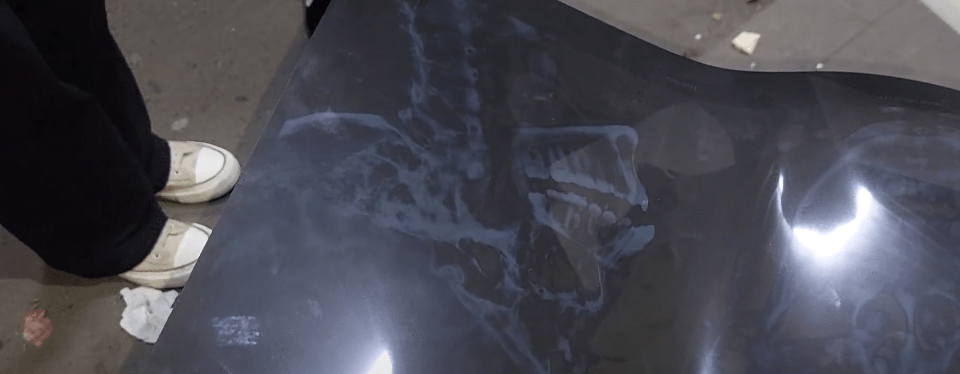 CHOFER EBRIO INVADE CARRIL E IMPACTA A BUS ESCOLAR CON SALDO DE HERIDOS&nbsp;GRAVES