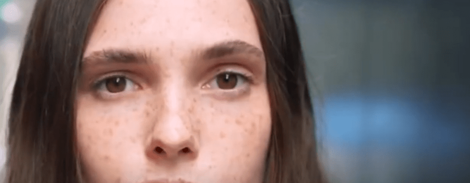 INVITAN A DETECCIÓN GRATUITA DE CANCER DE&nbsp;PIEL