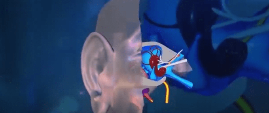 CON UNA VISITA ANUAL AL OTORRINO SE PREVIENE ENFERMEDADES DEL&nbsp;OÍDO