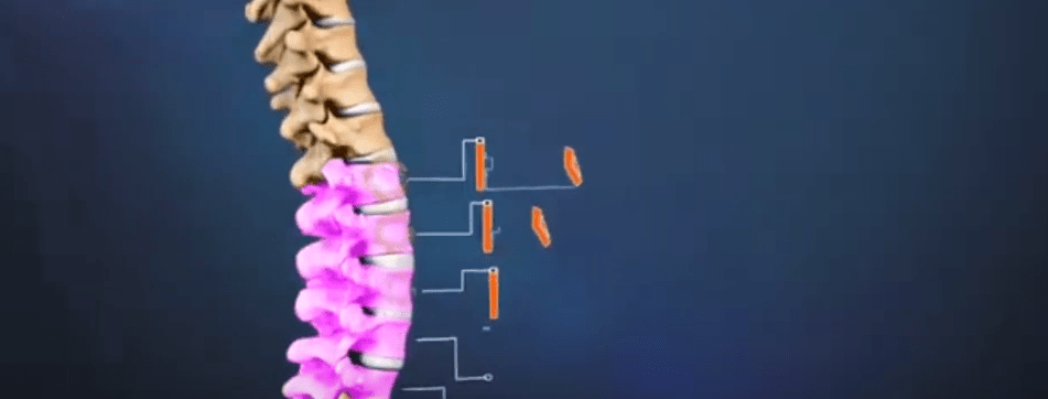 COLUMNA VERTEBRAL: ¡CUÍDATE CON LOS TACOS Y LAS MALAS&nbsp;POSTURAS