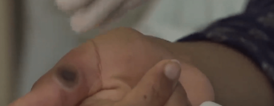 ¡CUIDADO CON LA VIRUELA DEL&nbsp;MONO!