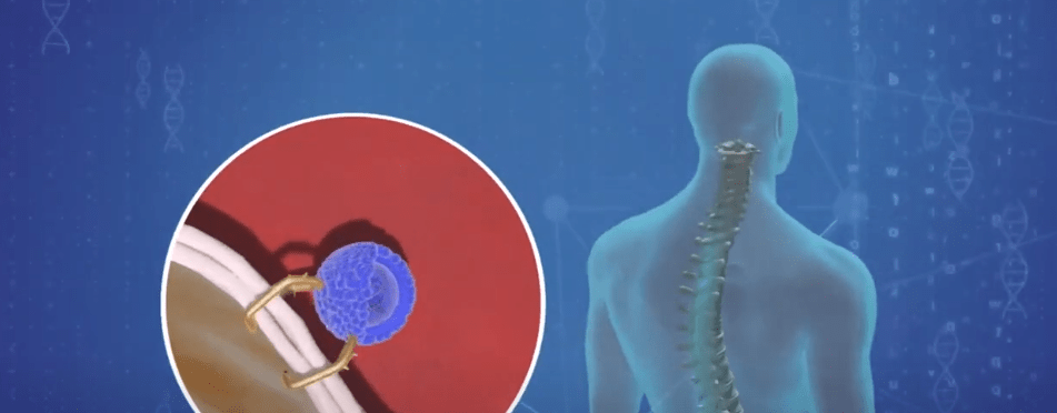 BROTES DE POLIOMIELITIS OBLIGA VACUNAR A NIÑOS HASTA 5&nbsp;AÑOS