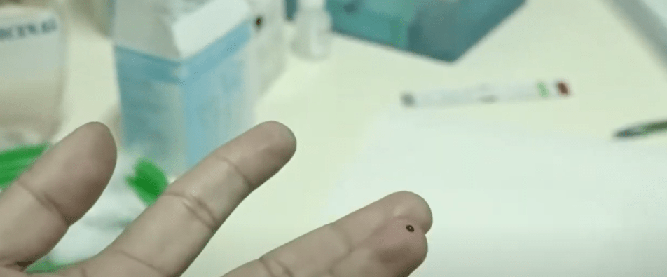 PREOCUPA CRECIMIENTO DE CASOS DE VIH SIDA EN&nbsp;JÓVENES