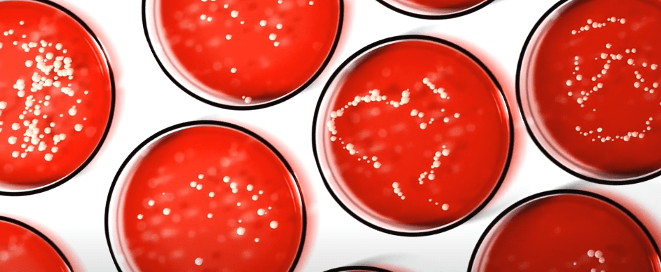 DECLARAN ALERTA SANITARIA EN COCHABAMBA POR PRESENCIA DE PELIGROSA&nbsp;BACTERIA