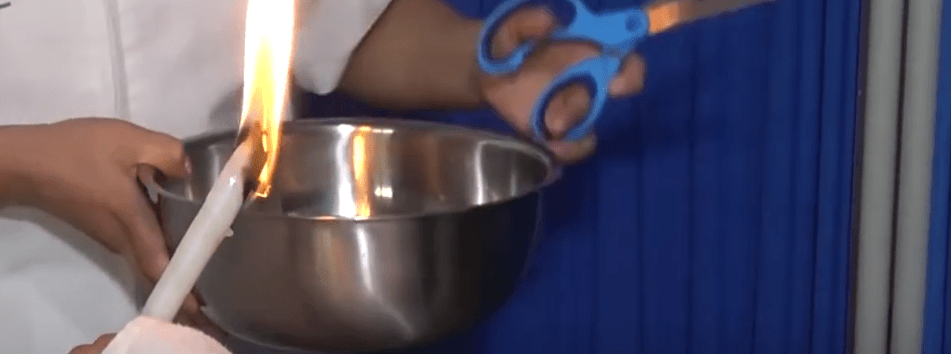 RECOMIENDAN “CORONOTERAPIA” PARA ALIVIAR DOLOR DE&nbsp;CABEZA