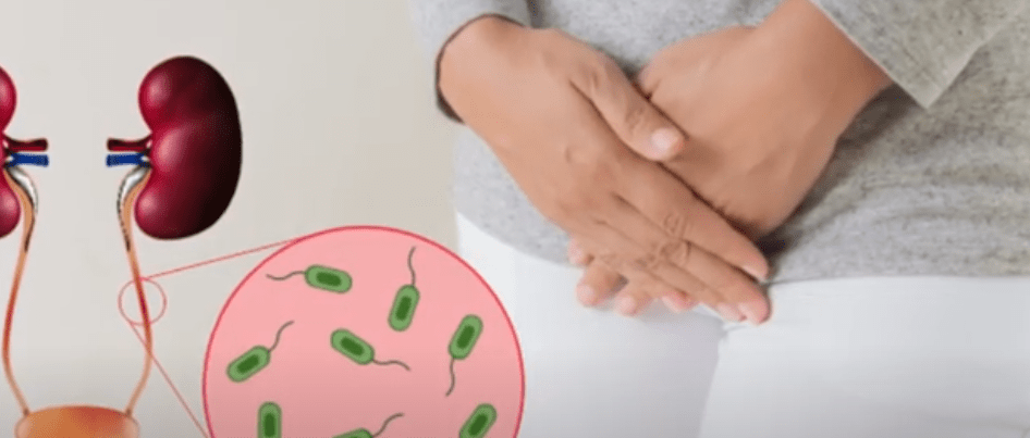 GINECÓLOGO:”SE DEBE CUMPLIR TRATAMIENTO COMPLETO Y NO&nbsp;INTERRUMPIRLO”