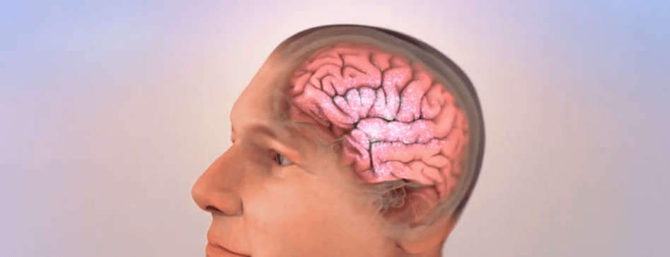 ¿COMO NVEJECER DEL CEREBRO DE MANERA&nbsp;SALUDABLE?