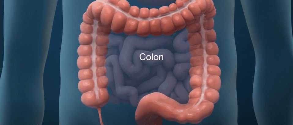 ALIMENTACIÓN SALUDABLE Y EJERCICIOS EVITAN CÁNCER DE&nbsp;COLON